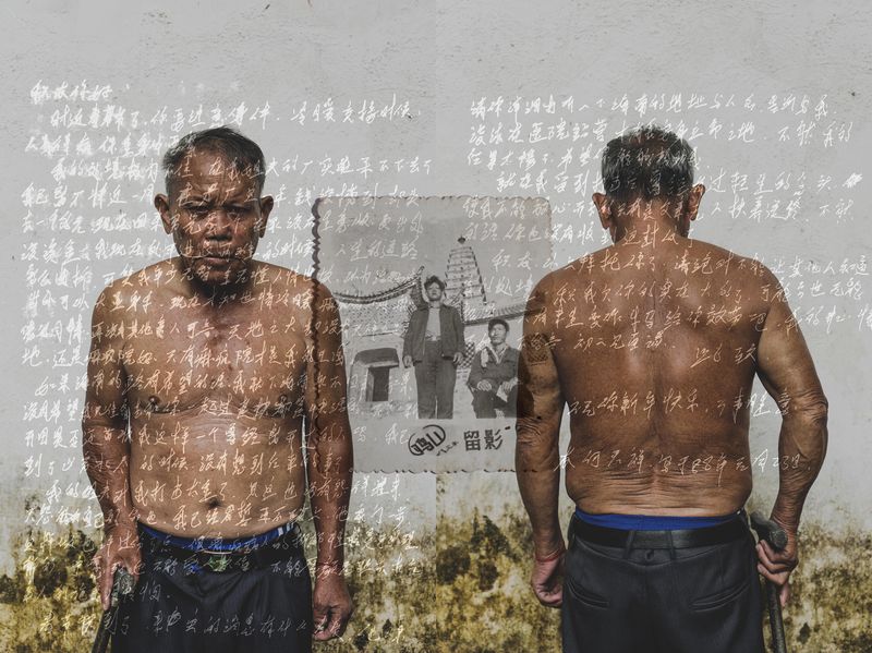 © Jin TIAN - Image from the CURSE OF THE WIND. A HISTORY OF LEPROSY IN CHIN photography project