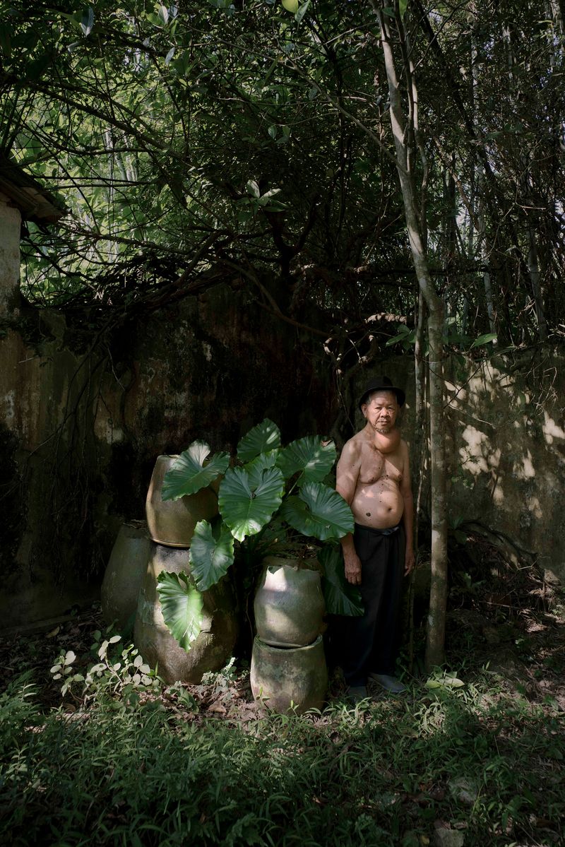 © Jin TIAN - Image from the CURSE OF THE WIND. A HISTORY OF LEPROSY IN CHIN photography project