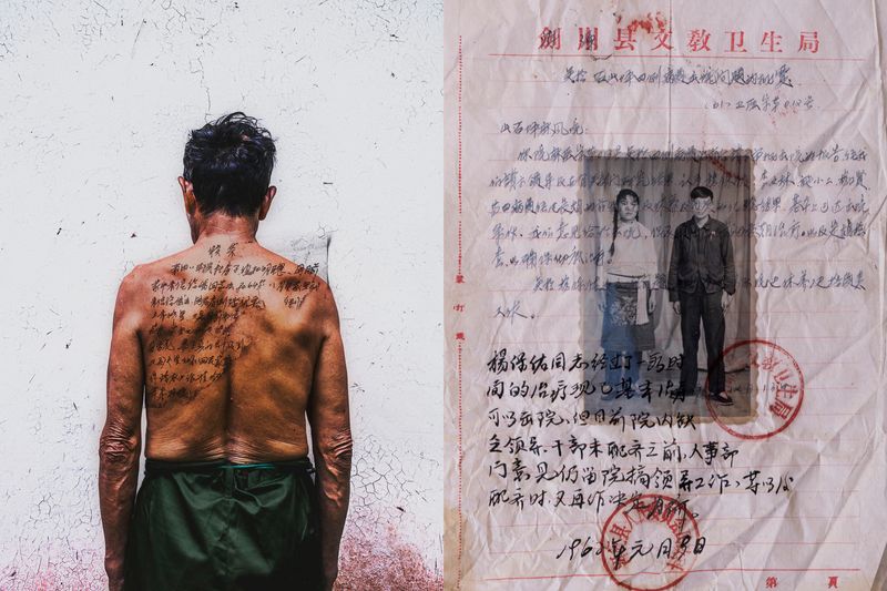 © Jin TIAN - Image from the CURSE OF THE WIND. A HISTORY OF LEPROSY IN CHIN photography project