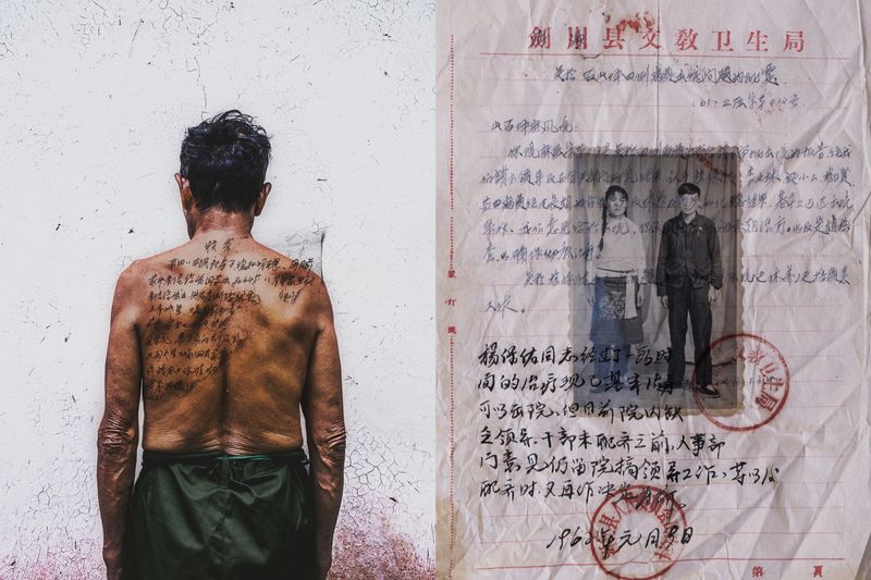 © Jin TIAN - Image from the CURSE OF THE WIND. A HISTORY OF LEPROSY IN CHIN photography project