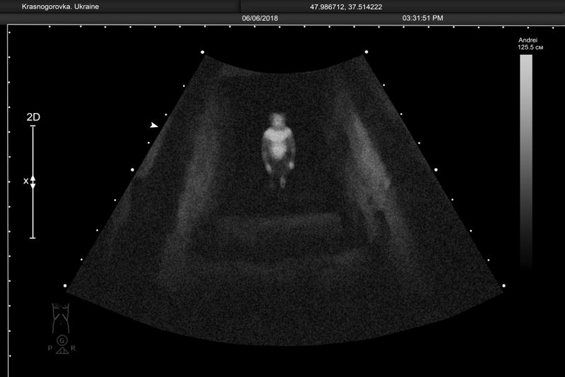 © Alena Grom - Image from the Womb photography project