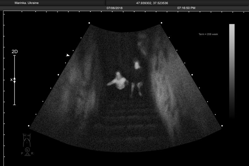 © Alena Grom - Image from the Womb photography project