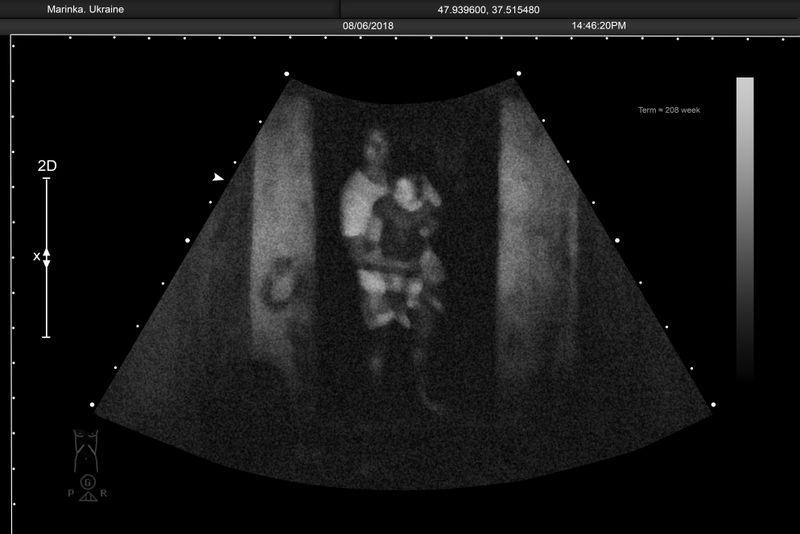 © Alena Grom - Image from the Womb photography project