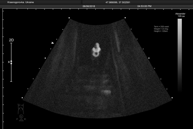 © Alena Grom - Image from the Womb photography project