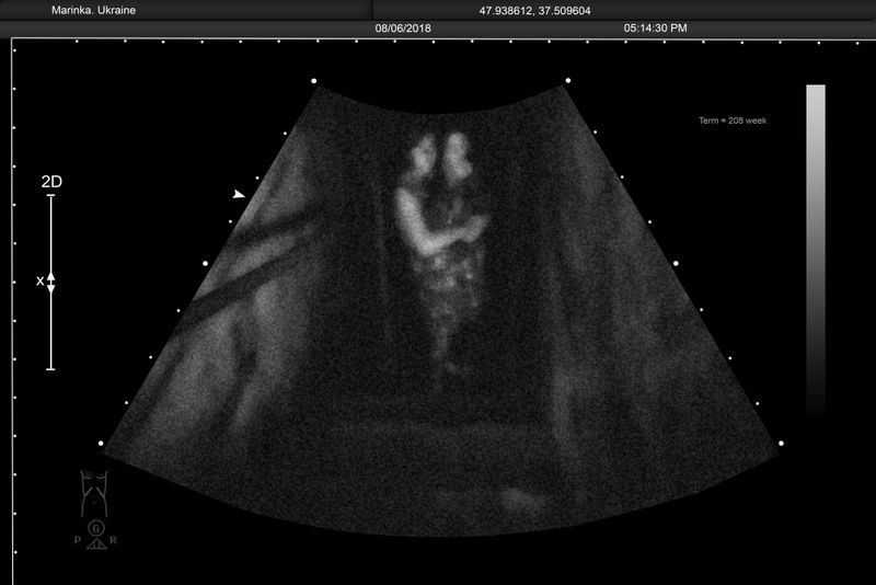 © Alena Grom - Image from the Womb photography project