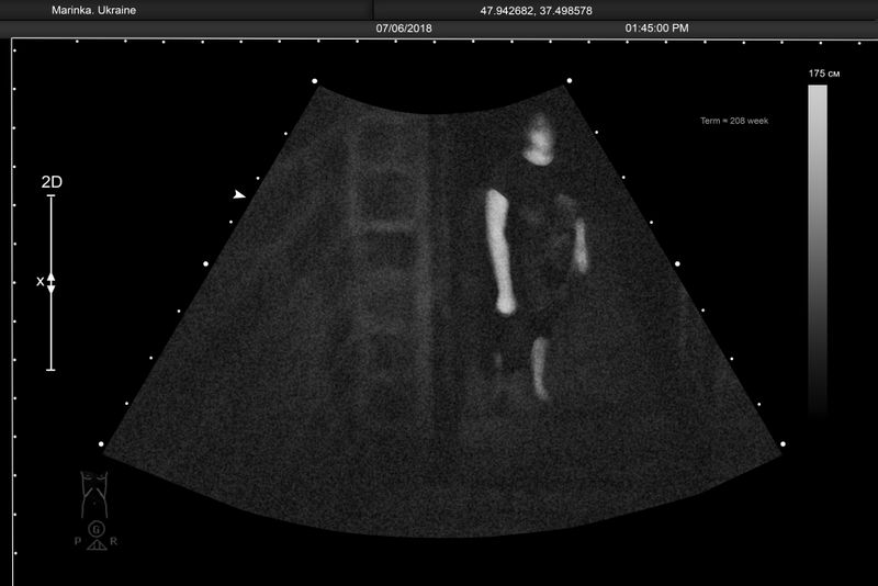 © Alena Grom - Image from the Womb photography project