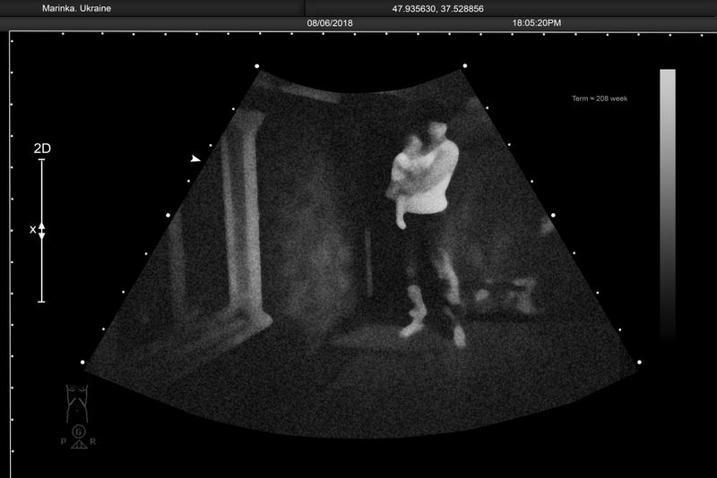 © Alena Grom - Image from the Womb photography project