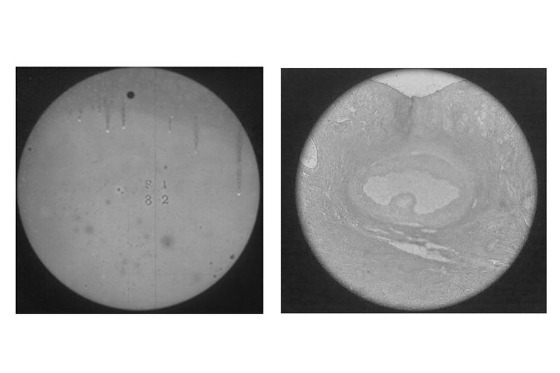 © Xanthe Hutchinson - L: The Transit of Venus R: Histology of an Ovary