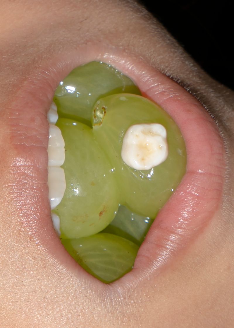 © Moritz Jekat - The Last Milk Tooth