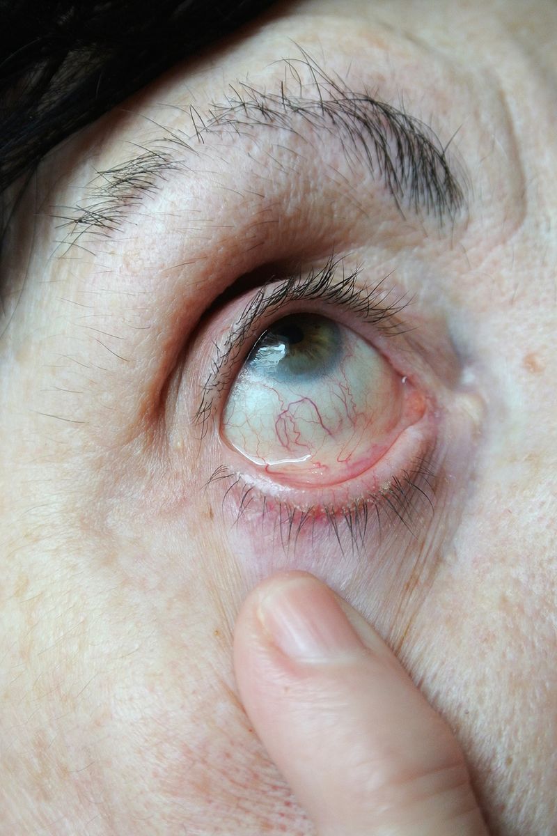 © Yiannis Trifonopoulos - Image from the The Sunken Place photography project