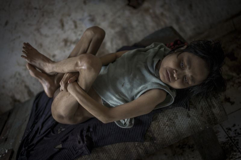 © Christian Werner - Image from the pasung - punished by the gods photography project