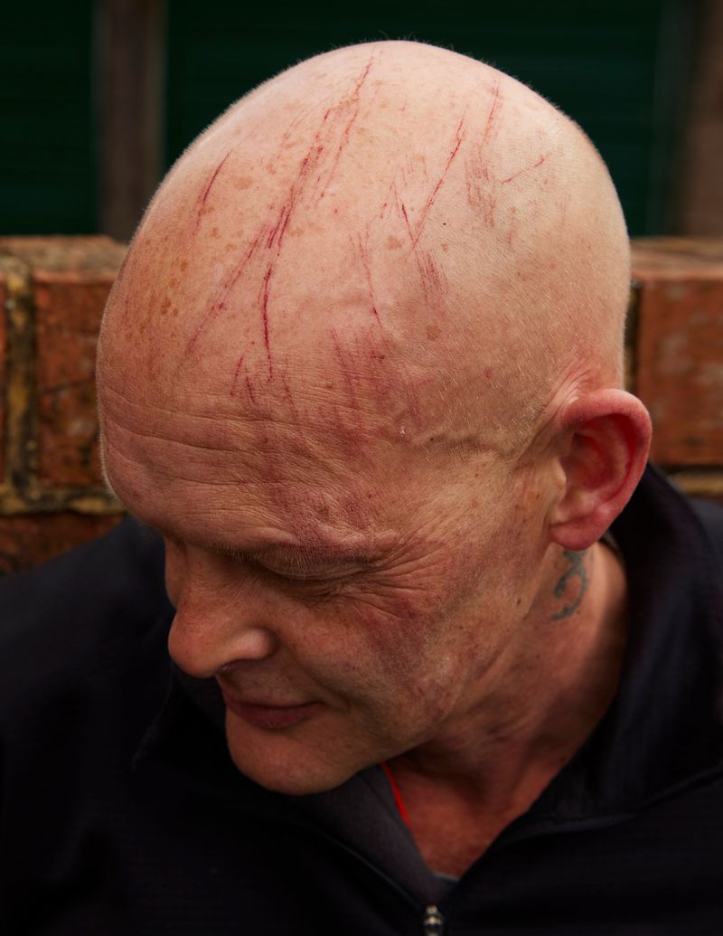 © David Vintiner - Phil - scratched head after playing Royal Shrovetide Football, Ashbourne