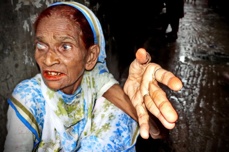 © Saiful Amin Kazal - Image from the BIHARI CAMPLIFE IN DHAKA photography project