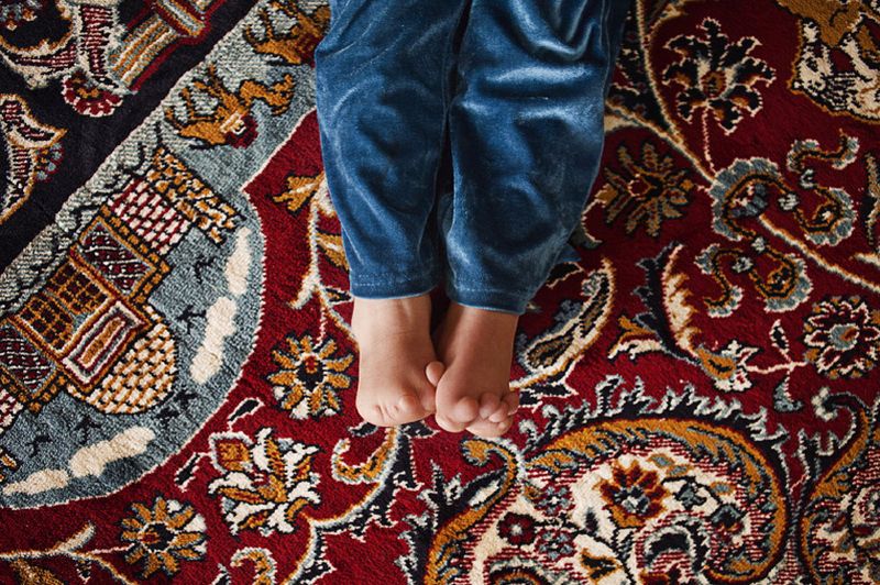© Antonio Zambardino - The feet of Hanar Baker, 9. Born on Feb 2 2004. She has a congenital malformations of the feet.