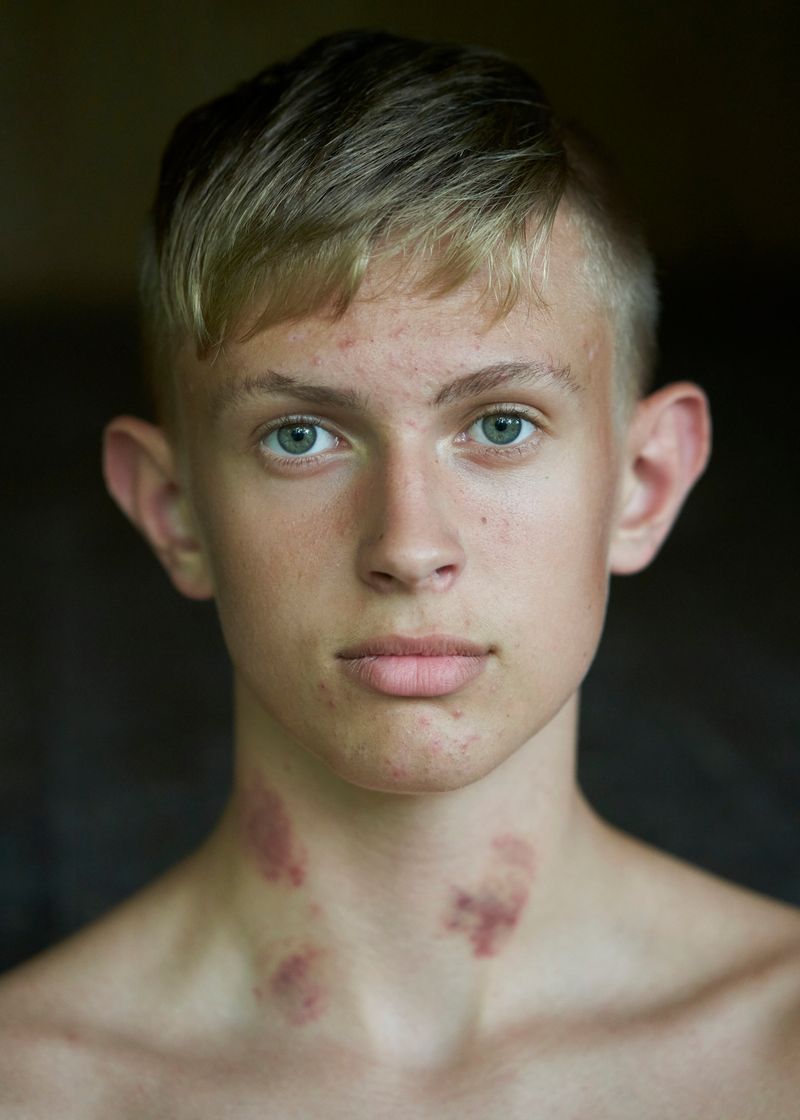 © Mads Joakim Rimer Rasmussen - Image from the One Year at Boarding School Amounts to Seven Years of Growth photography project