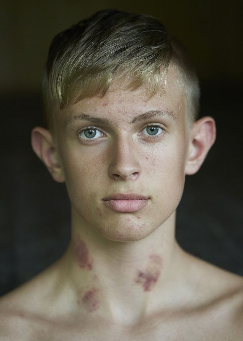 © Mads Joakim Rimer Rasmussen - Image from the One Year at Boarding School Amounts to Seven Years of Growth photography project