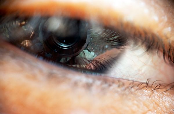 © Aslan Noorghasemi - Image from the Seeing The Nature in Macro photography project