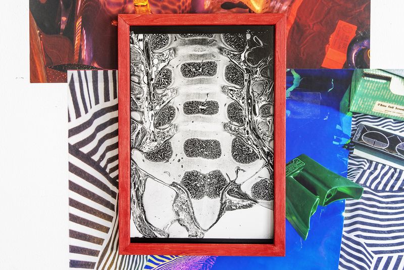 © Rachel Fein-Smolinski - Diagnostic Image, 1954*, reproduced 2019