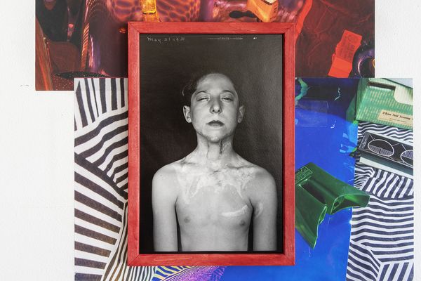 © Rachel Fein-Smolinski - Post-Op Portrait, 1931*, reproduced 2019