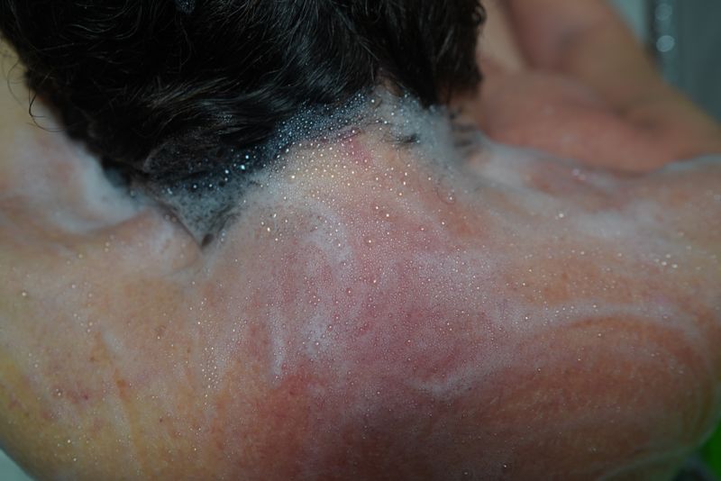 © Juan Pablo Ampudia - Image from the Trapped In My Own Body photography project