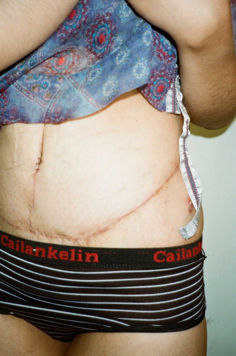 © Yu Hsuan Chang - Image from the G-book: Time Lives in the Body photography project