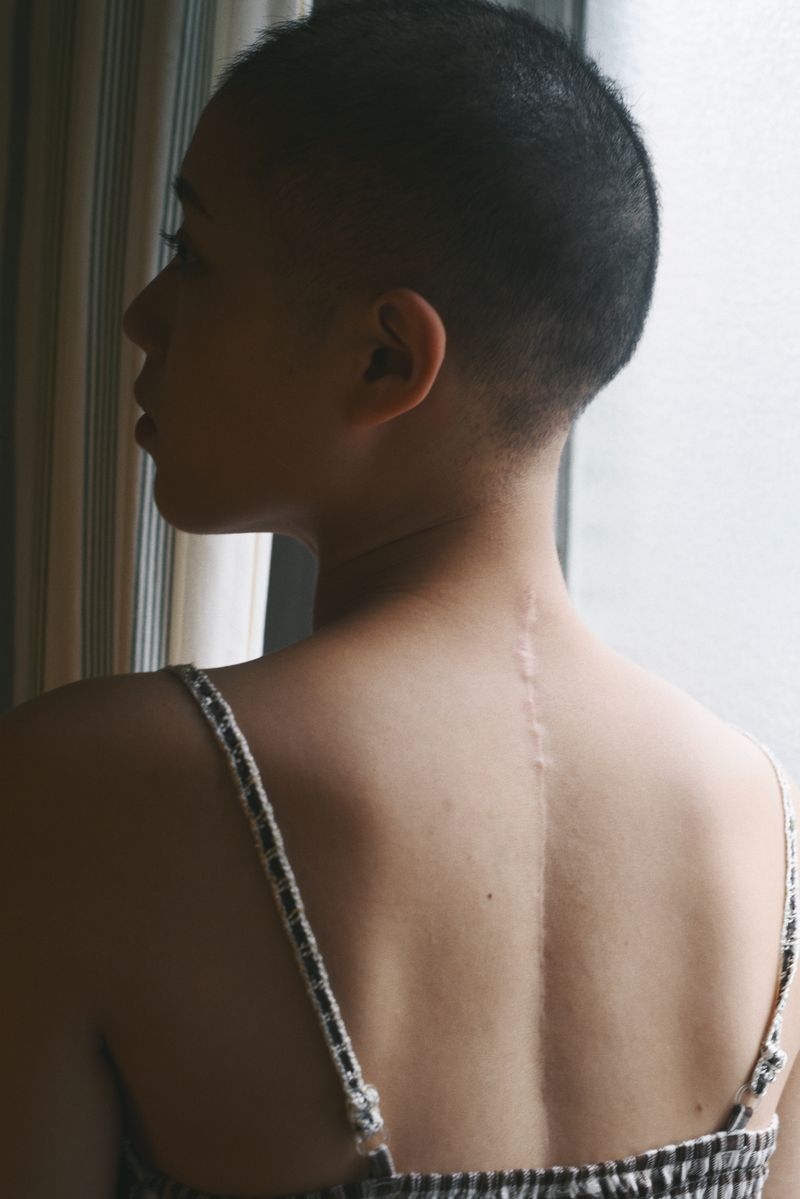 © Yu Hsuan Chang - a girl who has no choice but to be bald. She enjoys wearing different wigs everyday.