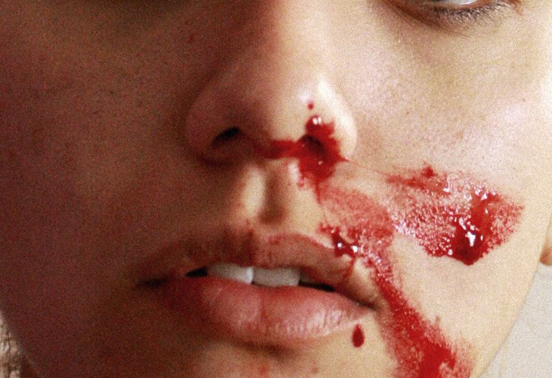 © Glorianna Ximendaz - Self-documentation was my primary tool to overcome and verbalize my trauma.