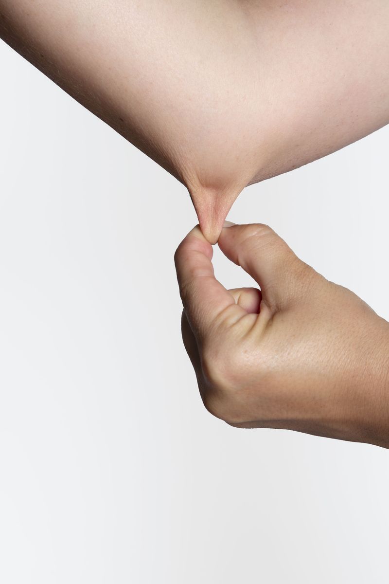 © Madelaine Ekserciyan - Skin 2,9 centimeters