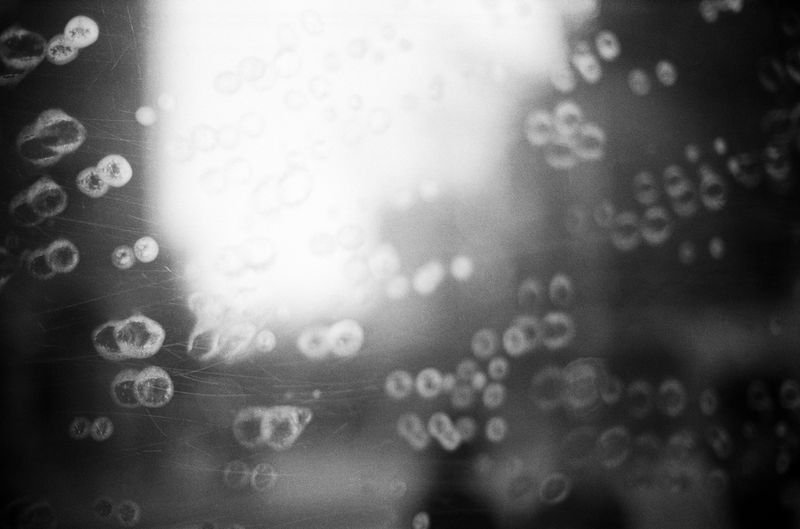 © Chunhan Chen - Image from the Never Normal, Never Perfect, Never Loved photography project