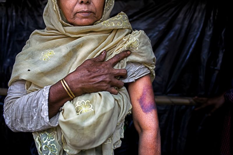 © K. M. Asad - Image from the Rohingya Refugee in Bangladesh photography project