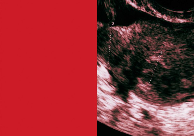 © Mayumi Suzuki - Image from the HOJO photography project