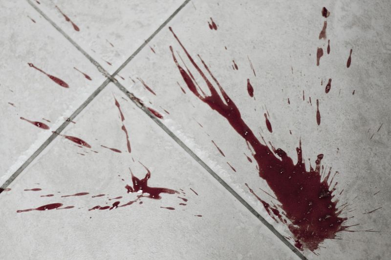 © Carlos Pozo Alban - Sangre en el suelo del hospital