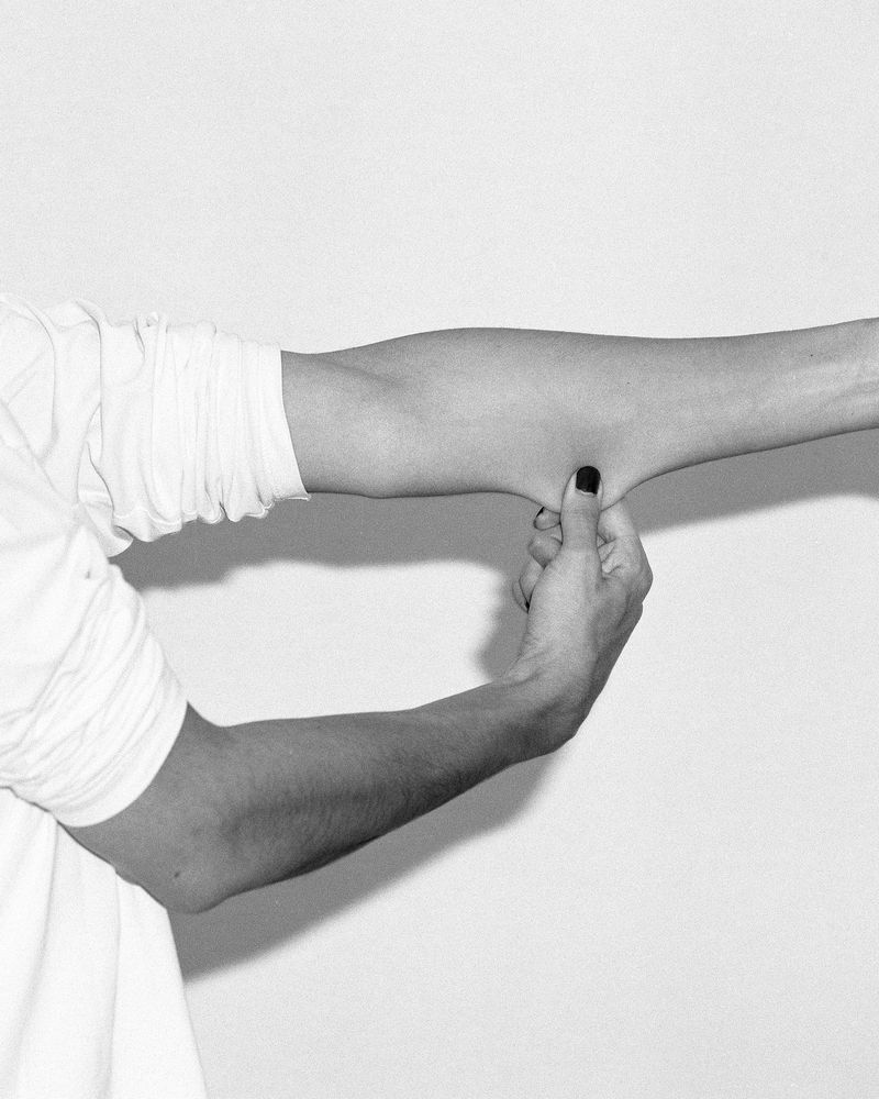 © Meg De Young - Skin Pinch, 2026