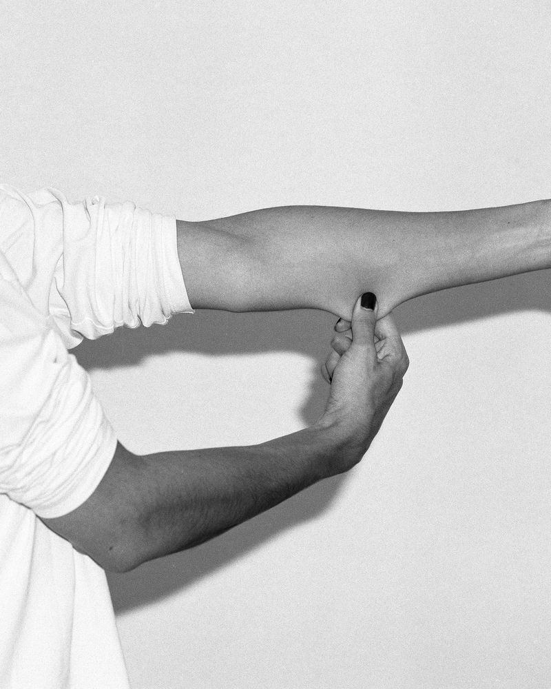 © Meg De Young - Skin Pinch, 2026