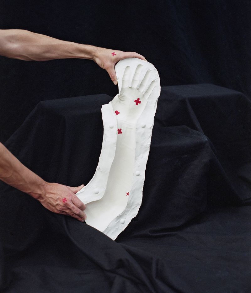 © Phelim Hoey - Mold of my arm with pain points