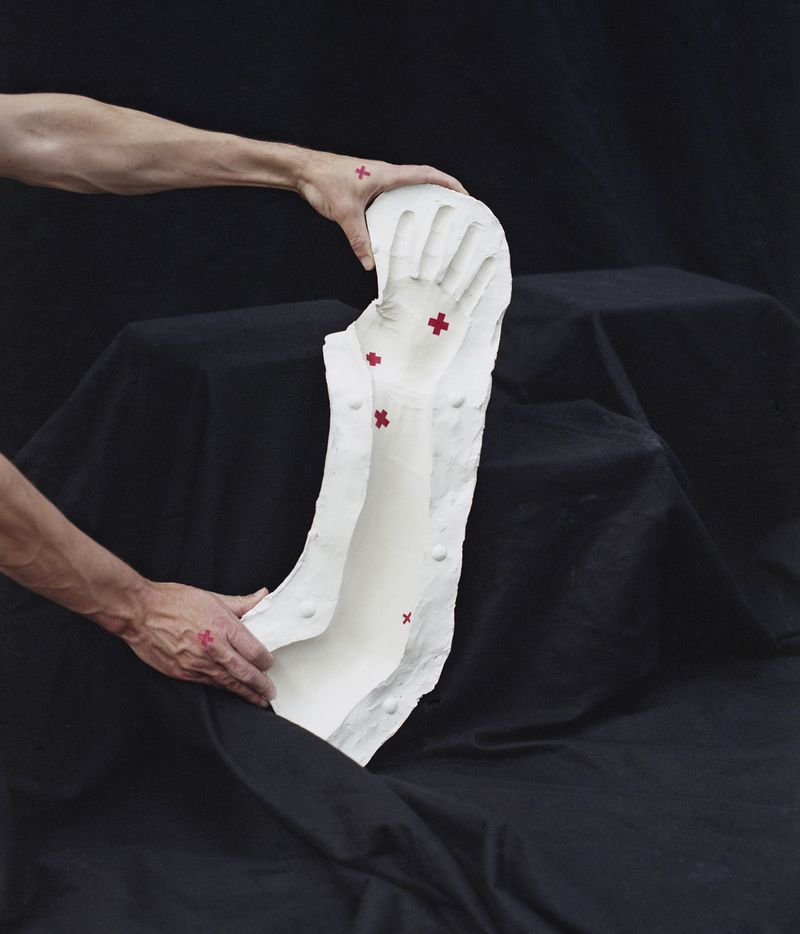 © Phelim Hoey - Mold of my arm with pain points