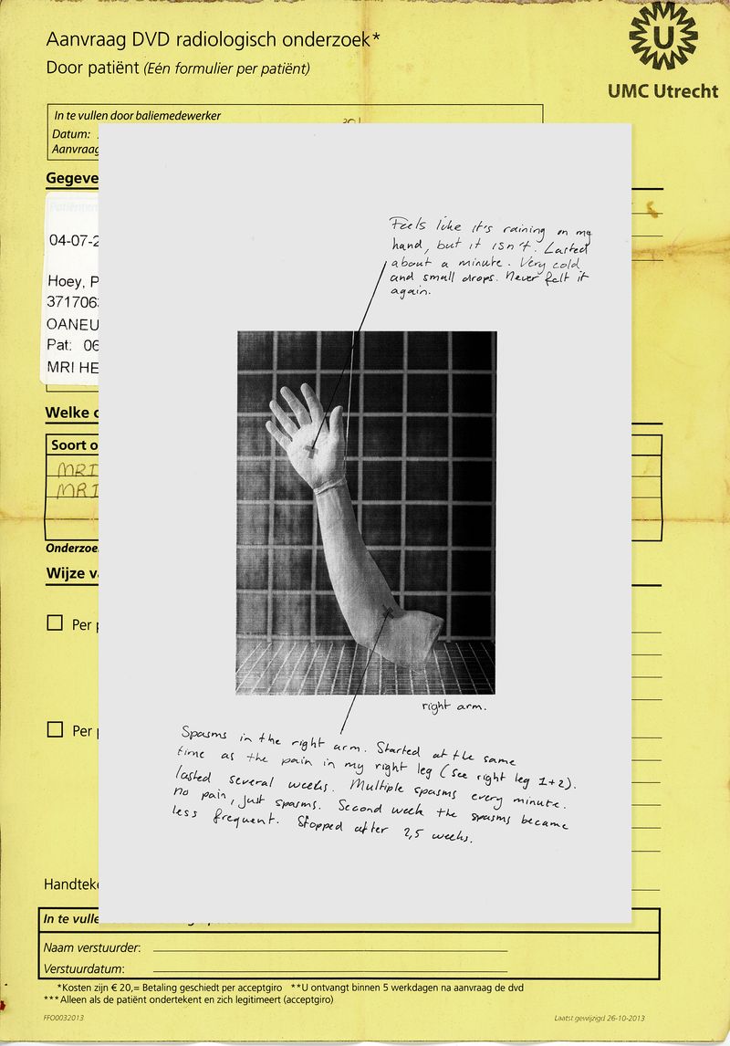 © Phelim Hoey - Diary entry with porcelain replica of my arm