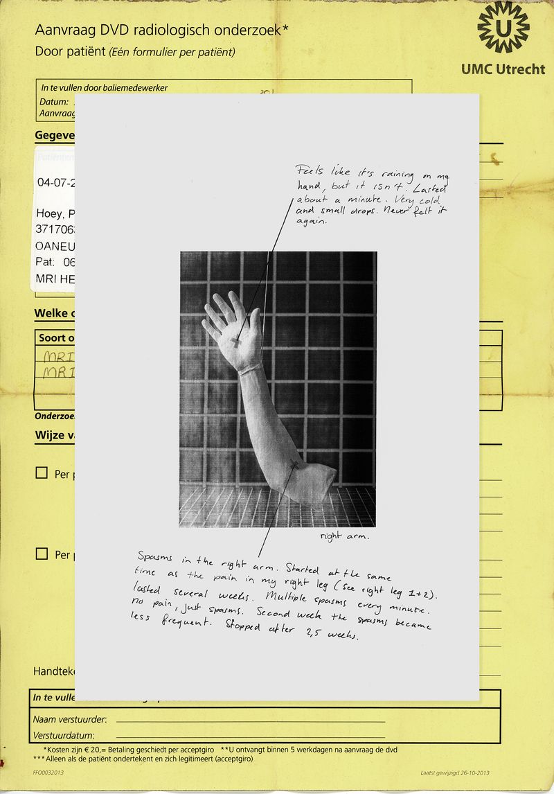 © Phelim Hoey - Diary entry with porcelain replica of my arm
