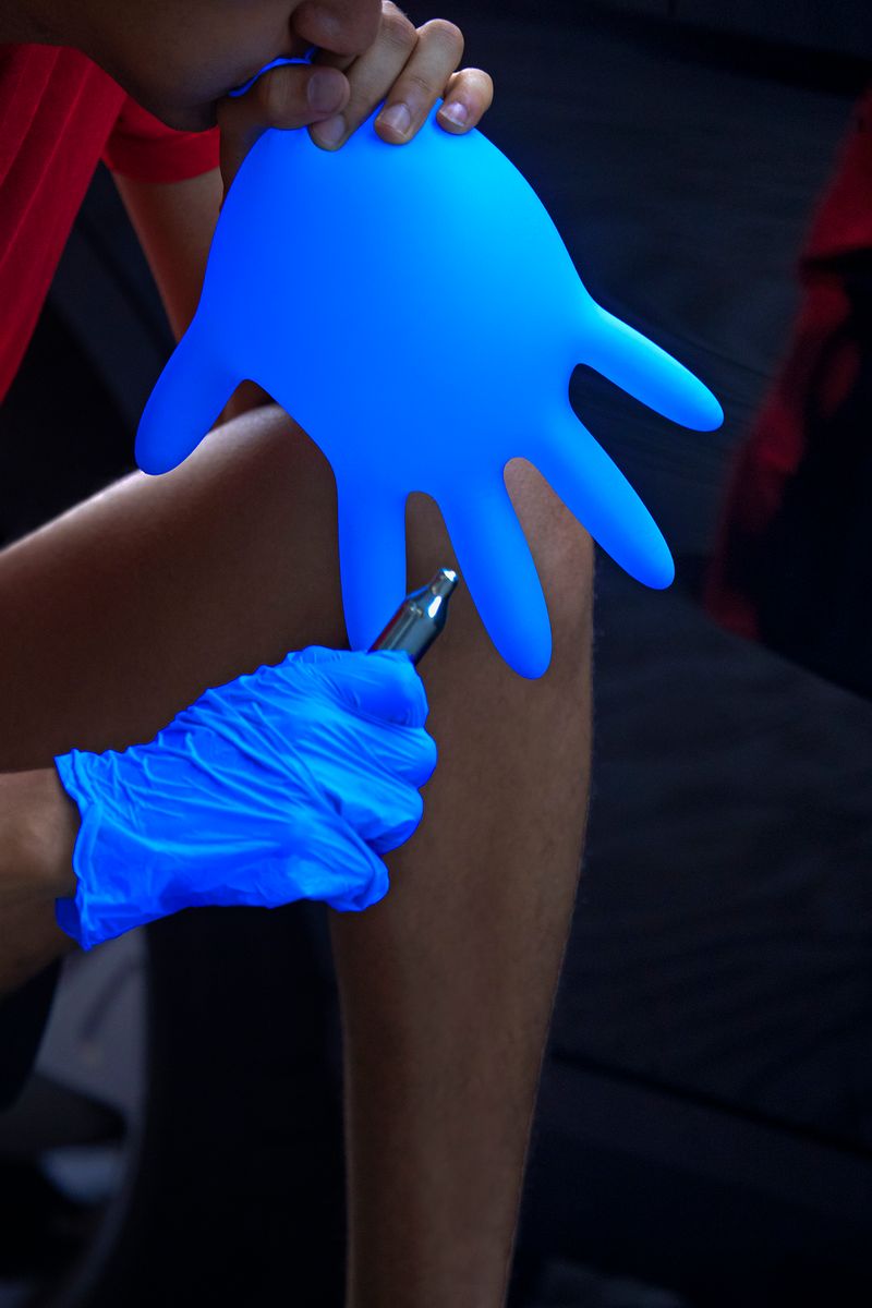 © Q - Xtreme Sighting no.16 - “N₂O in a Covid protection glove” Paris, France (2021)