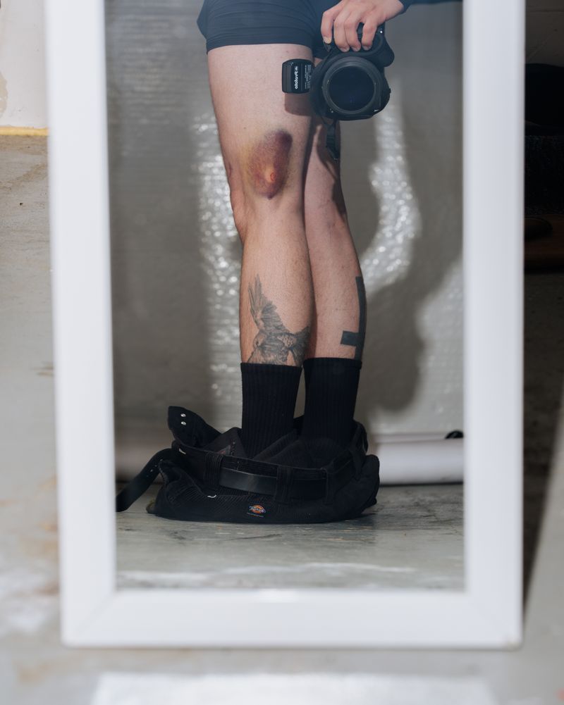 © Jordan Conway - While documenting a protest at the ICE facility in Portland, OR, I was targeted and shot with a rubber bullet.
