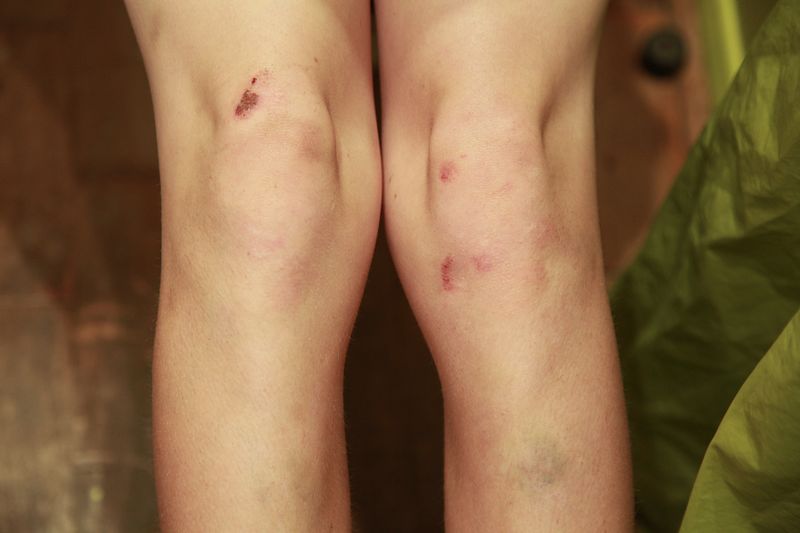 © Heather McDonough - body of a skateboarder