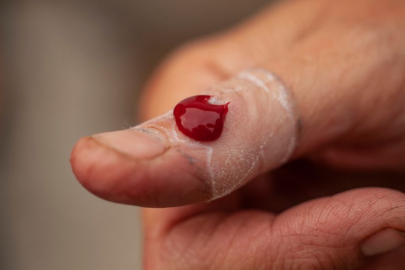 © Heather McDonough - Emma's thumb