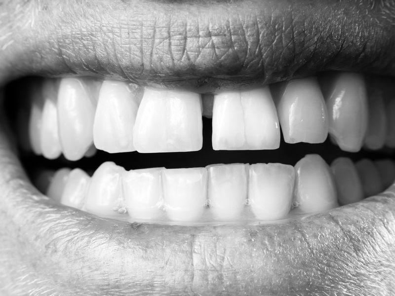 © Ganslmeier & Zibelnik - Image from the Bereitschaft photography project