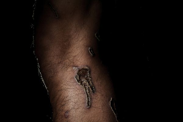 © Chung Ming Ko - Image from the Wounds of Hong Kong photography project