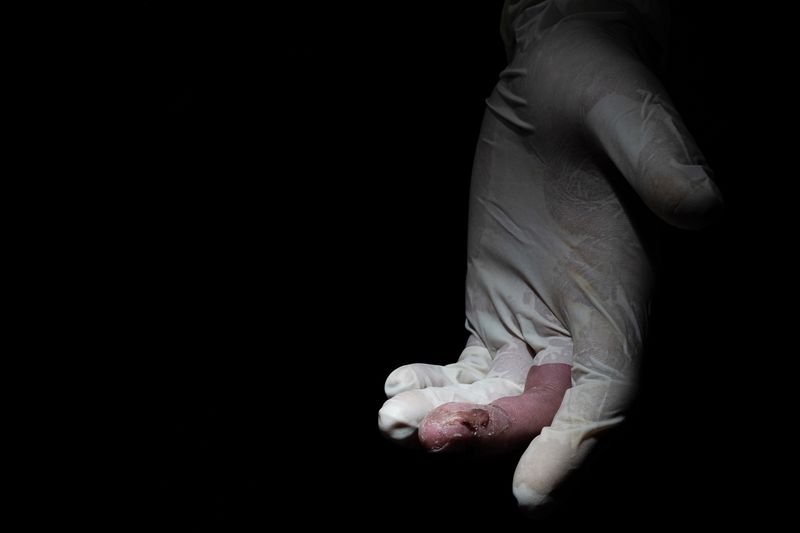 © Chung Ming Ko - Image from the Wounds of Hong Kong photography project