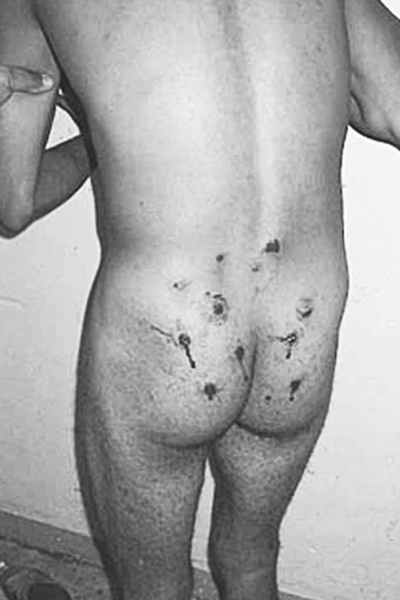 © Valentina Abenavoli - Image from the Anaesthesia photography project