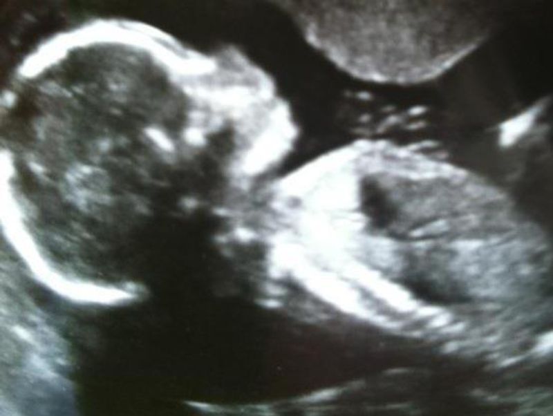 © Tyler Ashford - Image from the Matrescence photography project