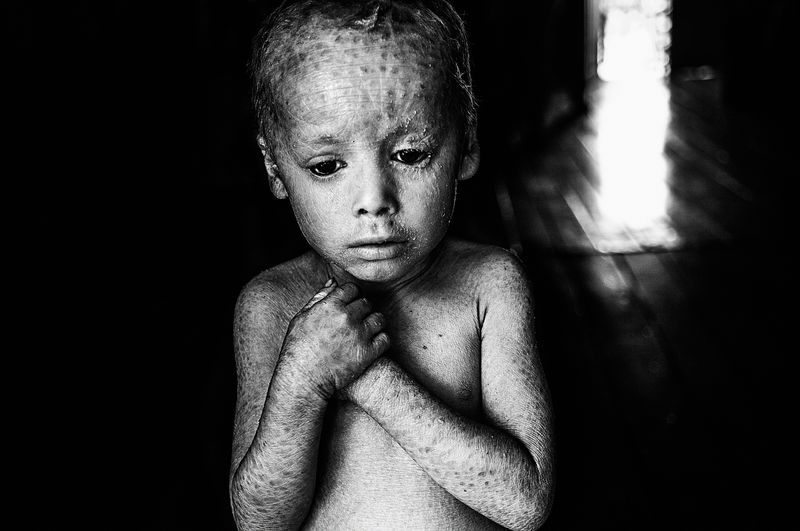 © Pablo Piovano - Image from the The human cost of agrotoxins photography project