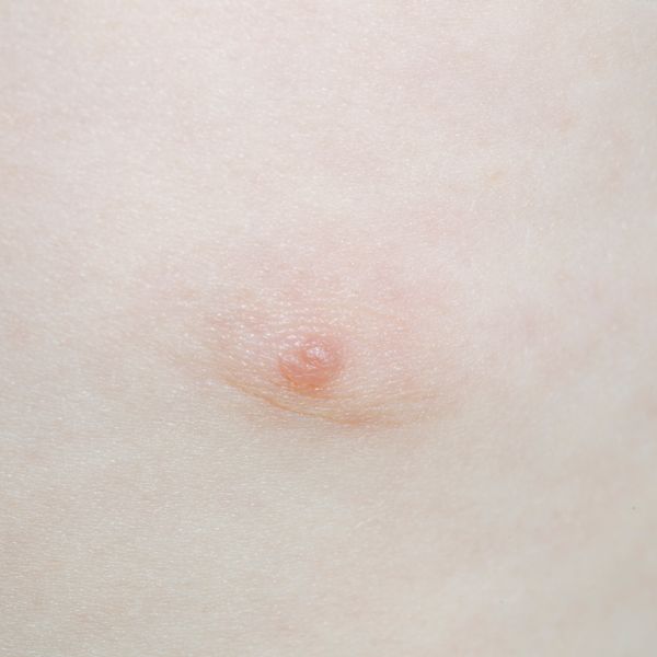 © Berglind Rögnvaldsdóttir - Image from the Uncensored photography project