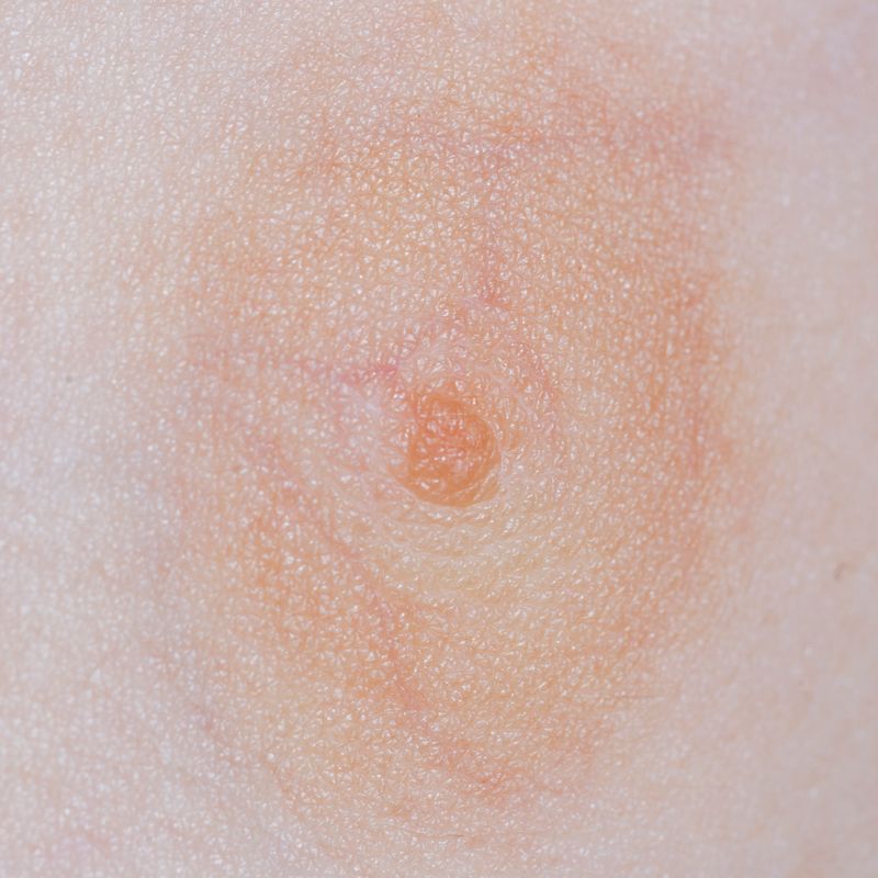 © Berglind Rögnvaldsdóttir - Image from the Uncensored photography project